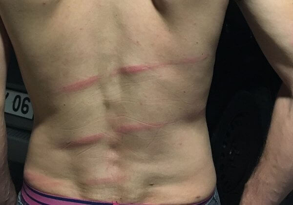 Des circassiens agressent violemment des militants pour les animaux en Avignon